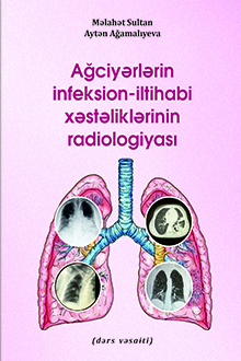 Ağciyərlərin infeksion‐iltihabi xəstəliklərinin radiologiyası