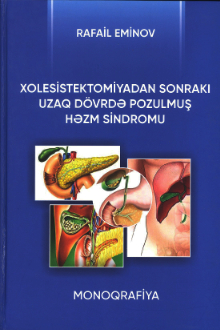 Xolesistektomiyadan sonrakı uzaq dövrdə pozulmuş həzm sindromu